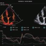 Φορητός Υπέρηχος Mindray ΜΕ7