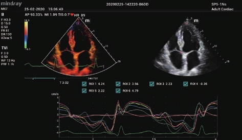Φορητός Υπέρηχος Mindray ΜΕ7