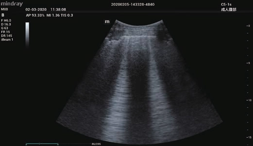 Φορητός Υπέρηχος Mindray ΜΕ7