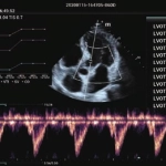 Φορητός Υπέρηχος Mindray ΜΕ7