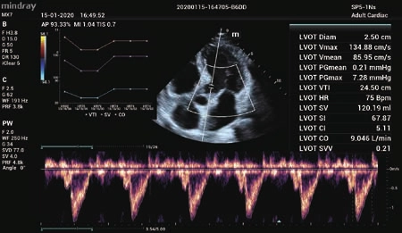 Φορητός Υπέρηχος Mindray ΜΕ7
