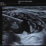 Φορητός Υπέρηχος Mindray ΜΕ7