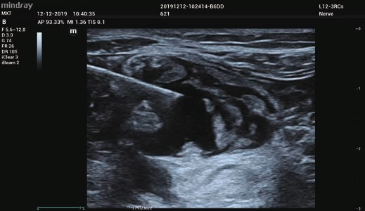 Φορητός Υπέρηχος Mindray ΜΕ7