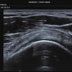 Φορητός Υπέρηχος Mindray ΜΕ7