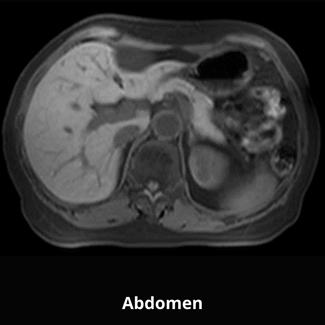 uMR 588 | uCS 1.5T MR