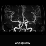 uMR 588 | uCS 1.5T MR