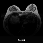 uMR 588 | uCS 1.5T MR