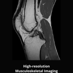 uMR 580 | Full-Digital 1.5T MR