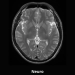 uMR 588 | uCS 1.5T MR