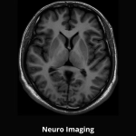 uMR 580 | Full-Digital 1.5T MR