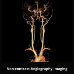 uMR 580 | Full-Digital 1.5T MR