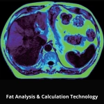 uMR 580 | Full-Digital 1.5T MR