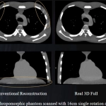 uCT960+ 640-slice CT