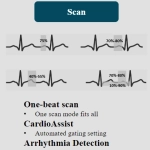 uCT960+ 640-slice CT