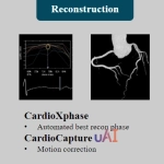 uCT960+ 640-slice CT
