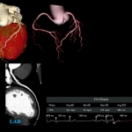 uCT960+ 640-slice CT
