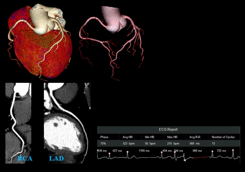 uCT960+ 640-slice CT