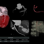 uCT960+ 640-slice CT
