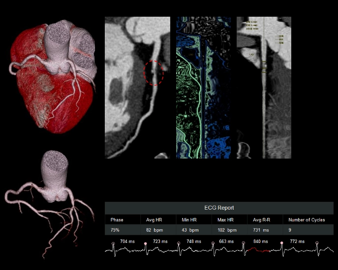 uCT960+ 640-slice CT