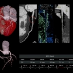 uCT960+ 640-slice CT