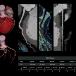 uCT960+ 640-slice CT