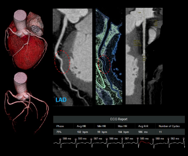 uCT960+ 640-slice CT