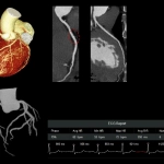 uCT960+ 640-slice CT