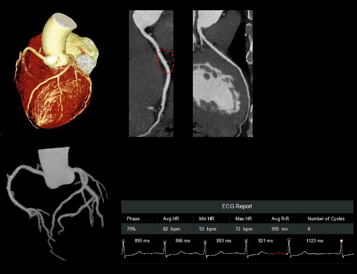 uCT960+ 640-slice CT