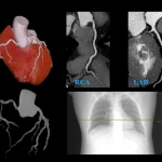 uCT960+ 640-slice CT