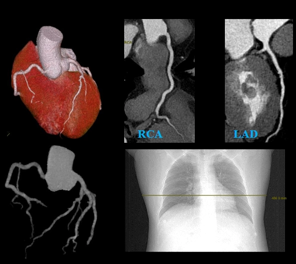 uCT960+ 640-slice CT
