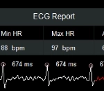 uCT960+ 640-slice CT