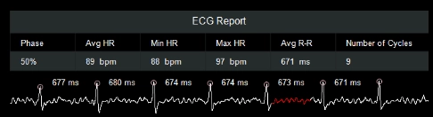 uCT960+ 640-slice CT