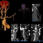 uCT960+ 640-slice CT