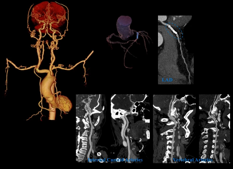 uCT960+ 640-slice CT