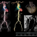 uCT960+ 640-slice CT