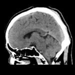 uCT960+ 640-slice CT