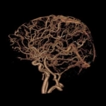 uCT960+ 640-slice CT