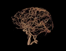 uCT960+ 640-slice CT