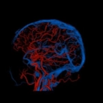 uCT960+ 640-slice CT