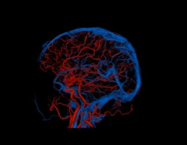uCT960+ 640-slice CT