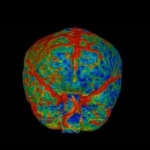 uCT960+ 640-slice CT