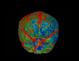 uCT960+ 640-slice CT