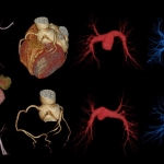 uCT960+ 640-slice CT