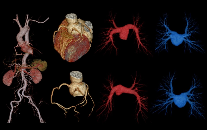 uCT960+ 640-slice CT