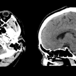 uCT960+ 640-slice CT