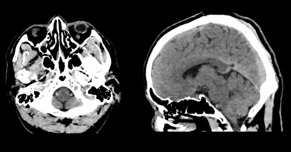 uCT960+ 640-slice CT