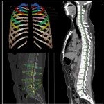 uCT960+ 640-slice CT