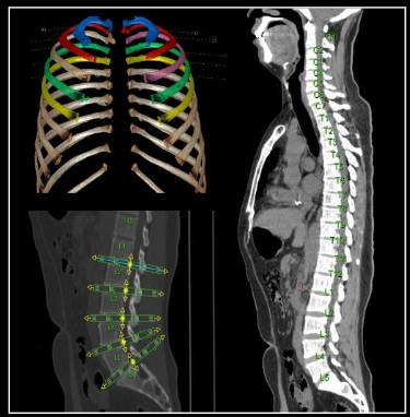 uCT960+ 640-slice CT