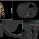 uCT960+ 640-slice CT