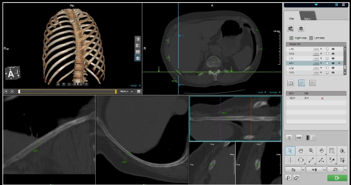 uCT960+ 640-slice CT